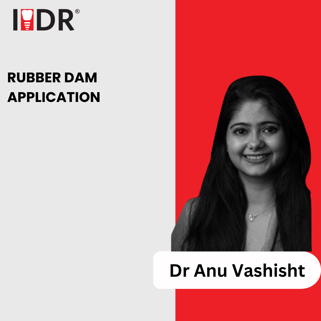 Damology Rubber Dam Application