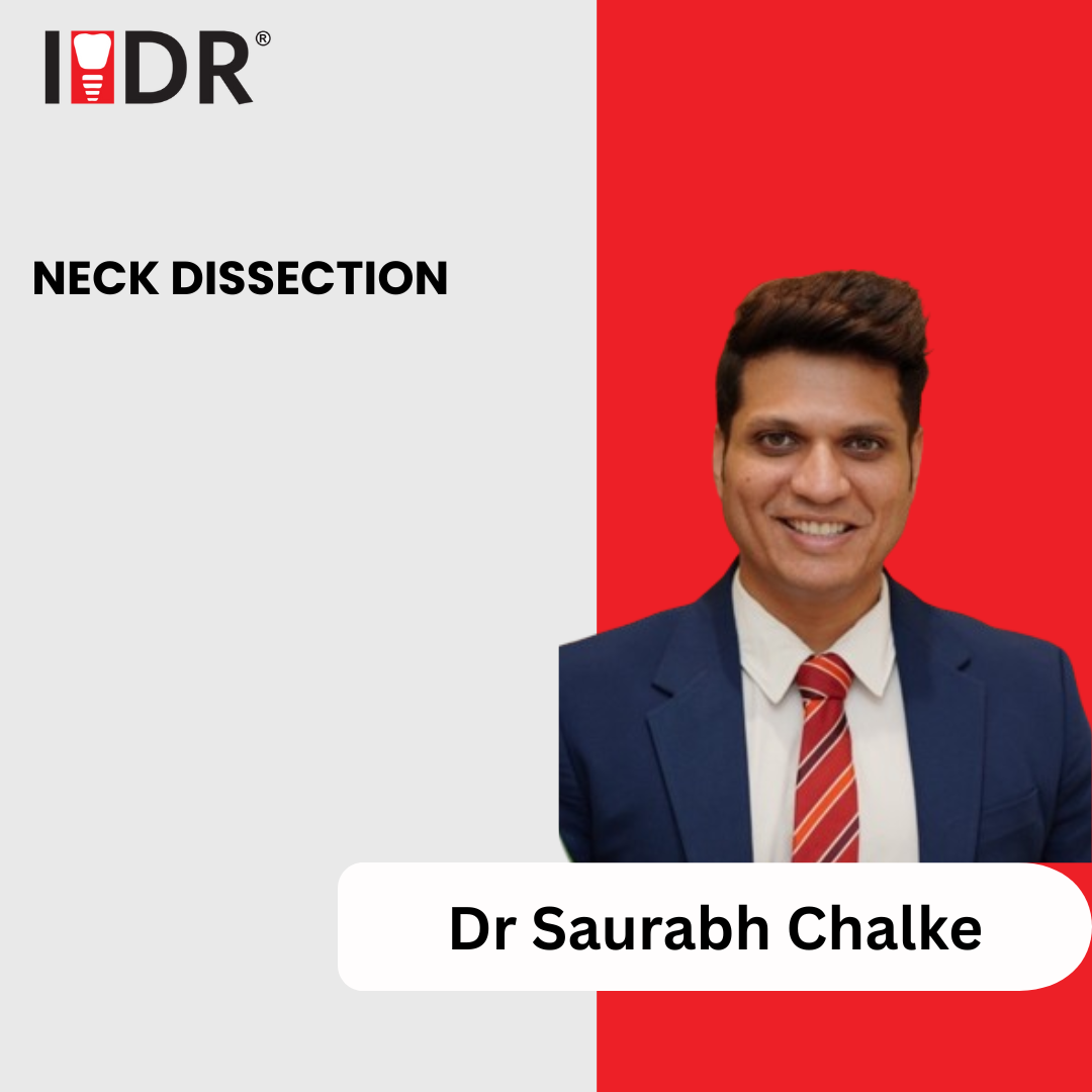 Neck Dissection Neck Dissection