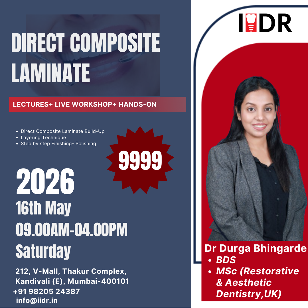 Direct Composite Laminate