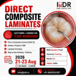 Mastering Direct Composite Laminate Technique