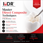 Mastering Direct Composite Laminate Technique