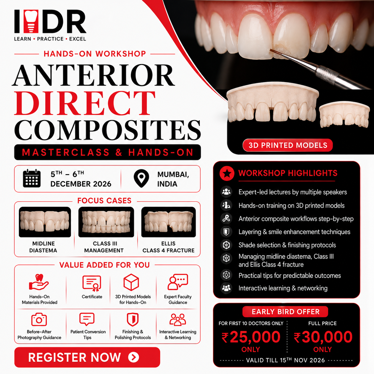 anterior direct composites, mumbai