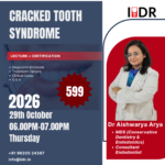 Cracked Tooth Syndrome